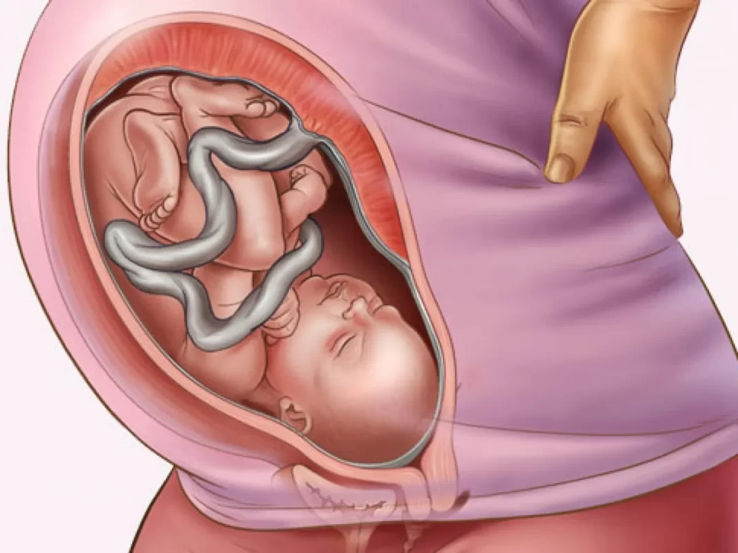 pregnant-Ecografía embarazo